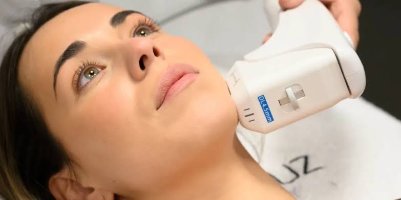 HIFU Facial - Papada